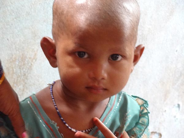 Salud infantil en India